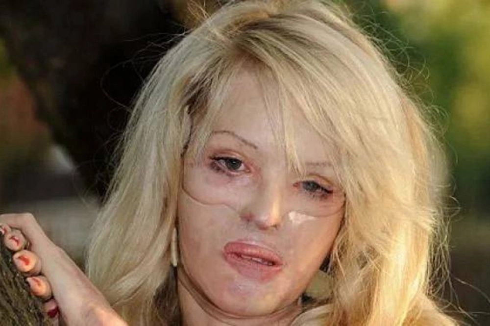 Литр кислоты. Как криминальный авторитет отомстил «Мисс Сочи» за отказ
Литр кислоты. Как криминальный авторитет отомстил «Мисс Сочи» за отказ